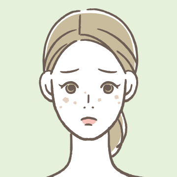 シミ・そばかす